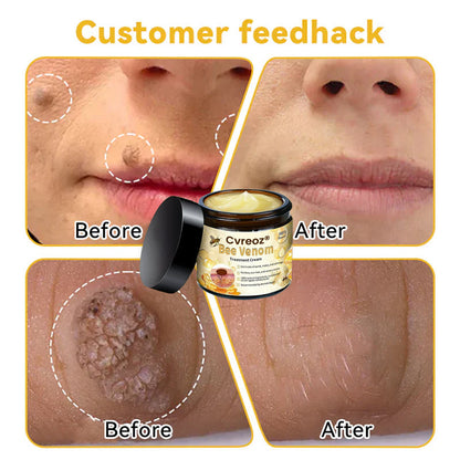 🌟 Last 14Pcs Left | Cvreoz® Bee Venom Skin Treatment Cream