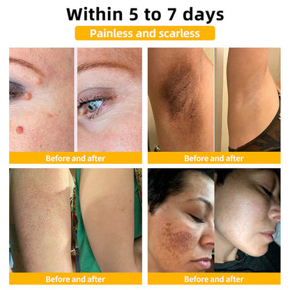 🌟 Last 14Pcs Left | Cvreoz® Bee Venom Skin Treatment Cream