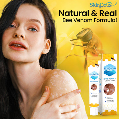 SkinDeux™ Bee Venom Vitiligo Cream -🌺Recommended by Expert Dermatologist!