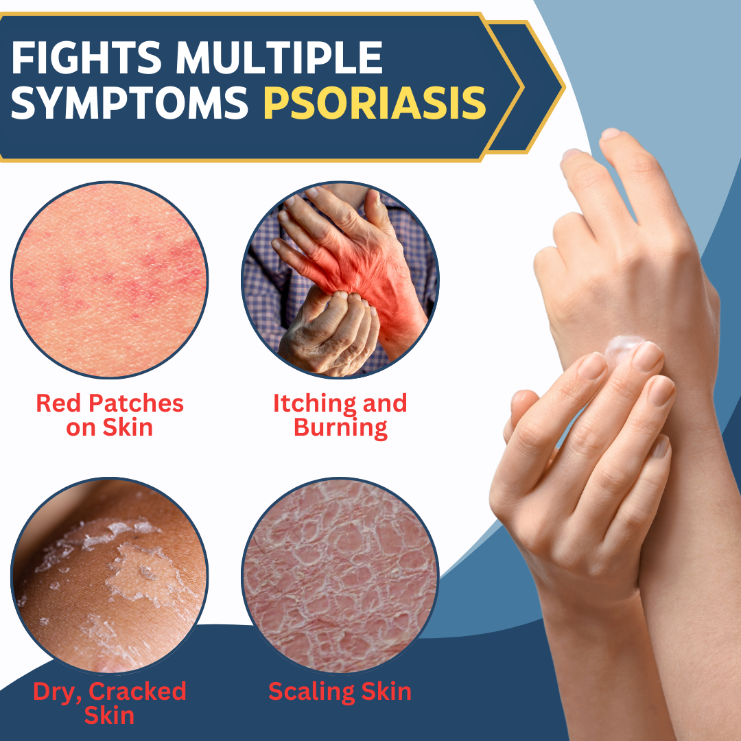 AEXZR™ Multi-Symptom Psoriasis Cream - 🧪Trusted by Experts!