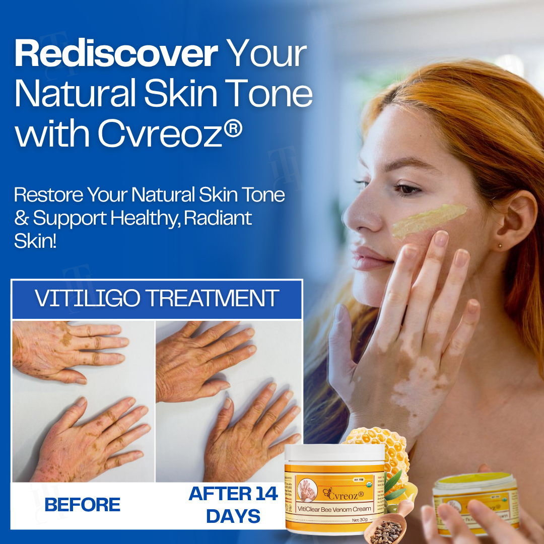 13 Pieces LEFT!!.. Cvreoz® VitiClear Bee Venom Cream
