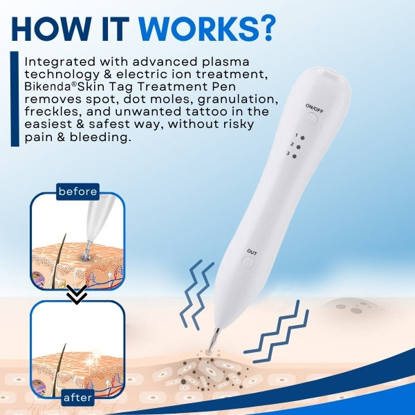 Official Store | Bikenda® Skin Tag Treatment Pen✅Just once a week, visible changes in 7 days🔥