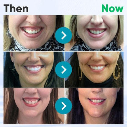 36 pcs left! AEXZR® 🎉 LIMITED TIME OFFER 🎉 Gum Therapy Gel