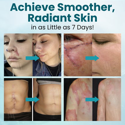 🌟 Official Store | Cvreoz® Advanced Scar Gel – Reveal Smooth, Healthier Skin Fast!✨