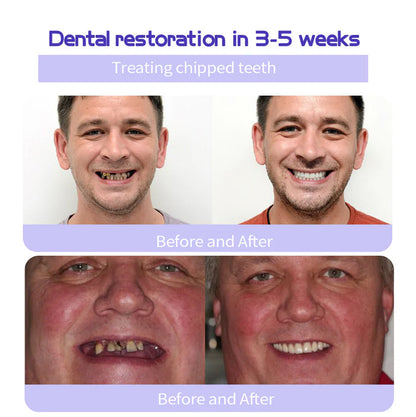 🌟 Official Store | AEXZR® Teeth Restoration Mineral Powder – Your Solution for a Healthier Smile!