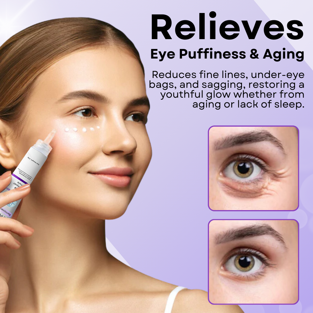 AEXZR™ Eye Puffiness Remover Cream - Recommended by a board-certified dermatologist!