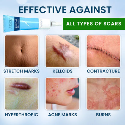 AEXZR™ Silicone Scar Gel - 👩‍⚕️ Trusted & Recommended By Dermatologist!