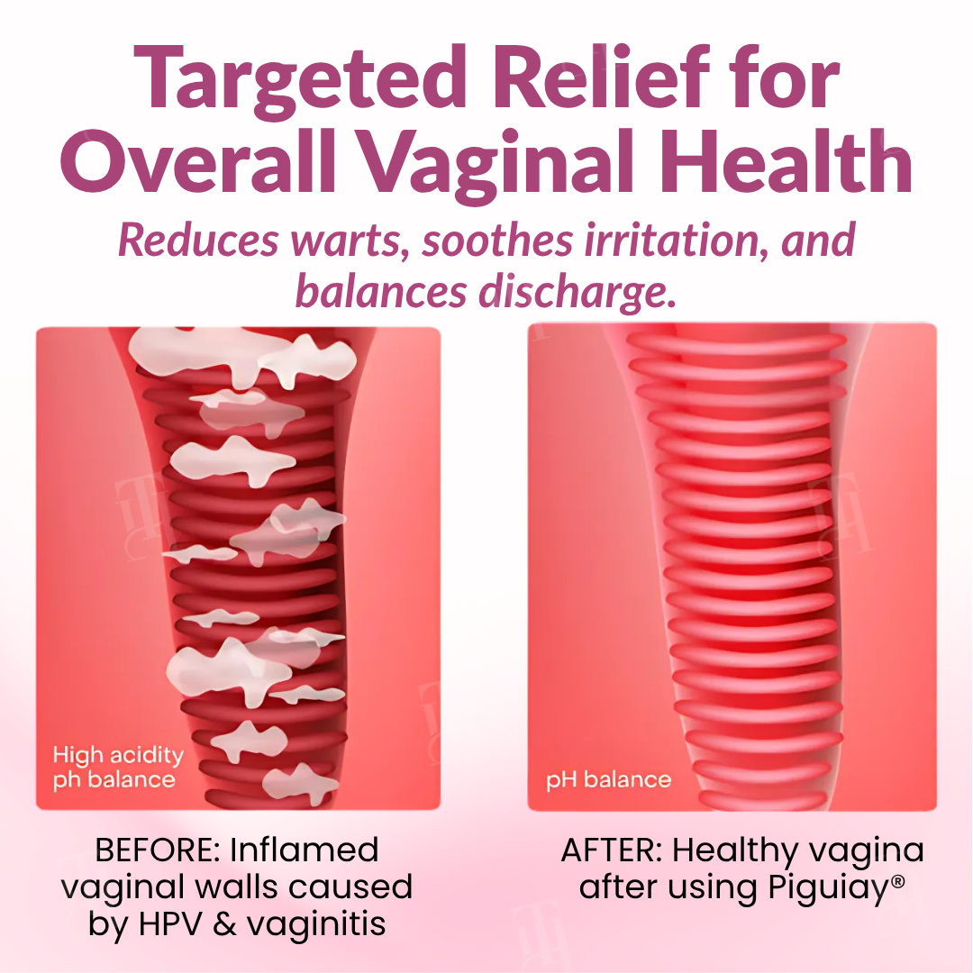🌸 Official Store | Piguiay® Femina HPV Relief Gel – Your Gentle Solution to HPV Symptoms!💕