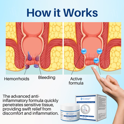 🌟 Official Store | LAST 31 PCS LEFT!🔥Hot Sale - 50% OFF🌿Cvreoz® Hemorrhoid & Fissure Cream