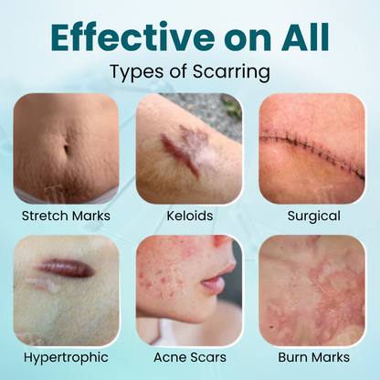 🌟 Official Store | Cvreoz® Advanced Scar Gel – Reveal Smooth, Healthier Skin Fast!✨