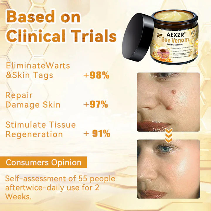 AEXZR™ Bee Venom Skin Treatment Cream - 🔥Recommended by Experts in Skin Care!👩‍⚕️