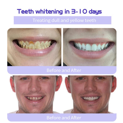 🌟 Official Store | AEXZR® Teeth Restoration Mineral Powder – Your Solution for a Healthier Smile!