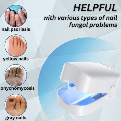 🔥Hot Sales - 50% OFF🔥Bikenda® Nail Fungus Laser Treatment Device