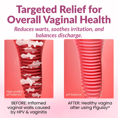 🌟 Official Store | Piguiay® Femina HPV Relief Capsules – Unlock Comfort and Confidence!