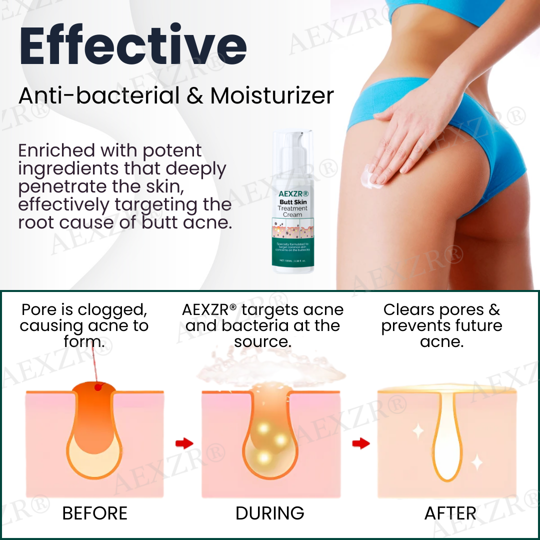 🌟 Official Store | AEXZR® Butt Skin Treatment Cream💕 Say Goodbye to Bumps and Hello to Smooth, Radiant Skin!