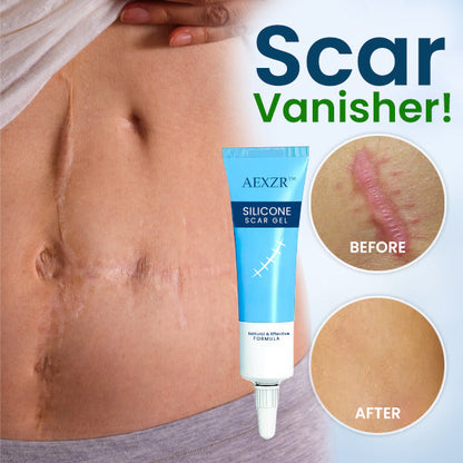 AEXZR™ Silicone Scar Gel - 👩‍⚕️ Trusted & Recommended By Dermatologist!