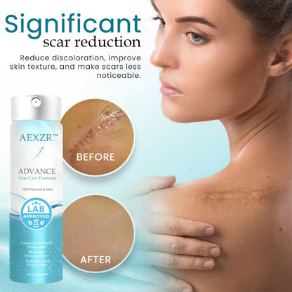 AEXZR™ Advance Scar Care Formula - 🌺🌺Recommended by Skin Doctors (Dermatologist)