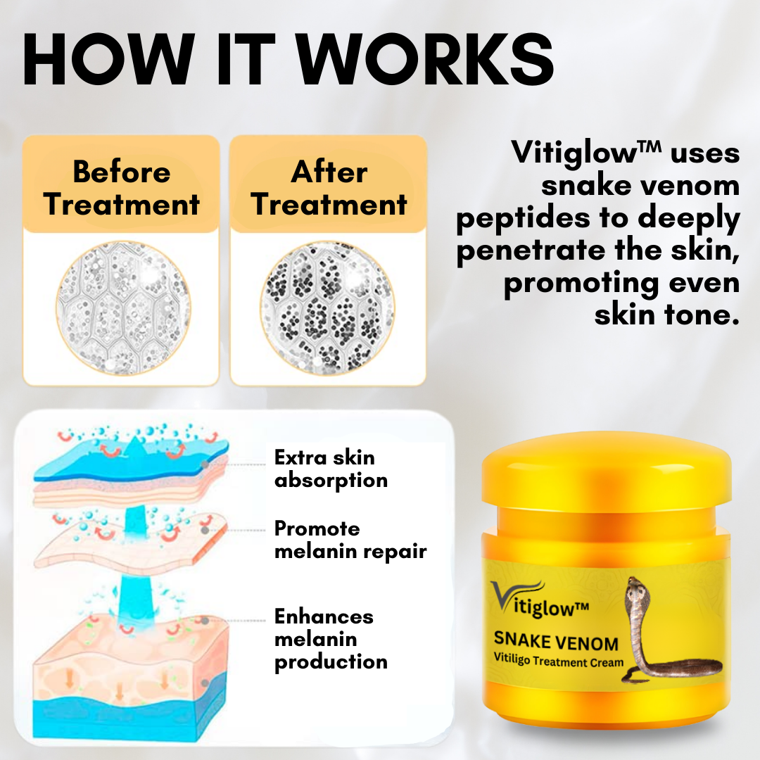 Vitiglow™ Snake Venom Vitiligo Treatment Cream - 👨‍⚕️ Dermatologists & Experts Approved!