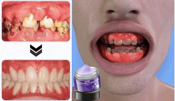 🌟 Official Store | AEXZR® Teeth Restoration Mineral Powder – Your Solution for a Healthier Smile!