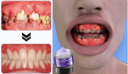 🌟 Official Store | AEXZR® Teeth Restoration Mineral Powder – Your Solution for a Healthier Smile!