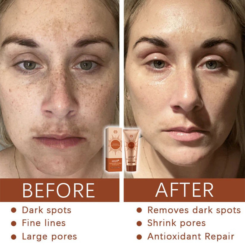 AEXZR® Herbal Spots ✅ 𝕤𝕒𝕧𝕖 𝕦𝕡 𝕥𝕠 𝟟𝟘% Peel-Off Facial Mask
