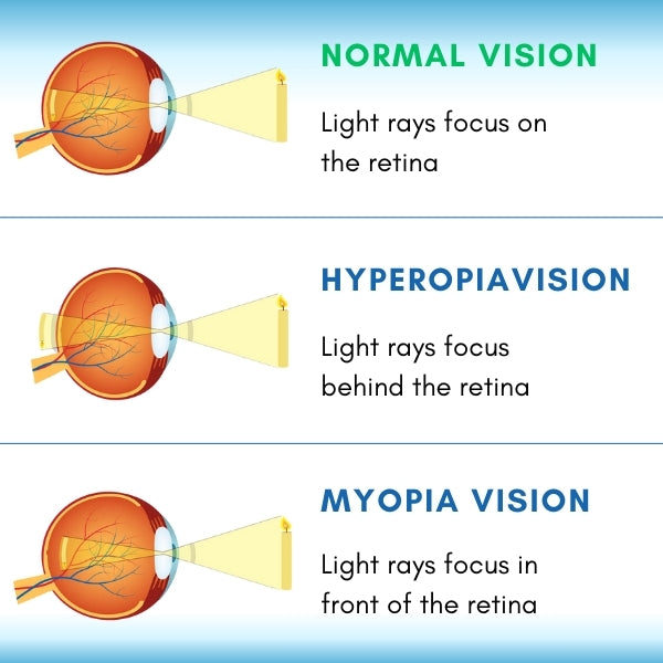 VizoClear™ Daily Liquid Lens - 👩‍⚕️ Recommended by Experts! 🔥 30-Days Money-Back Guarantee! 💰