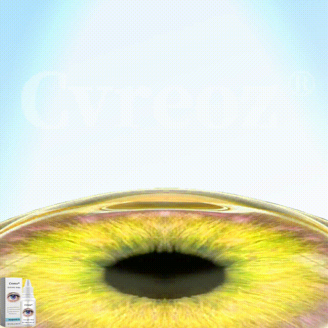 🌟 Official Store |🔥Hot Sale - 50% OFF🌿| Cvreoz® EyeCandy Drops