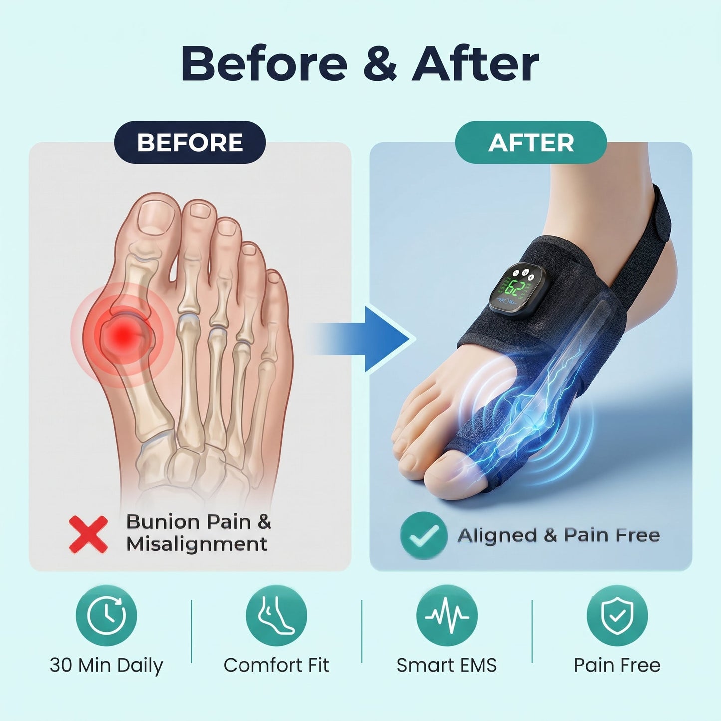 AEXZR® Nexalign Pro — EMS Bunion Corrector