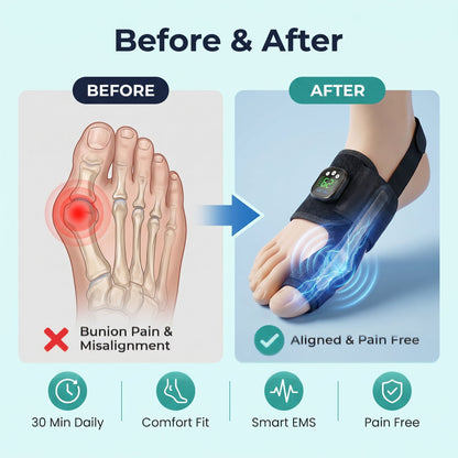 AEXZR® Nexalign Pro — EMS Bunion Corrector