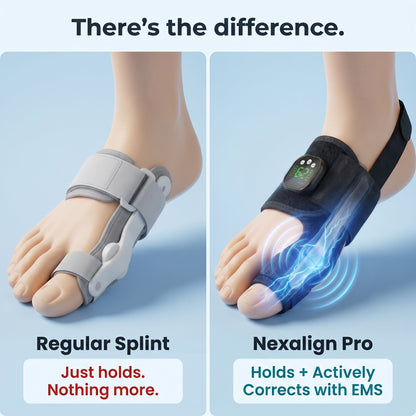 AEXZR® Nexalign Pro — EMS Bunion Corrector