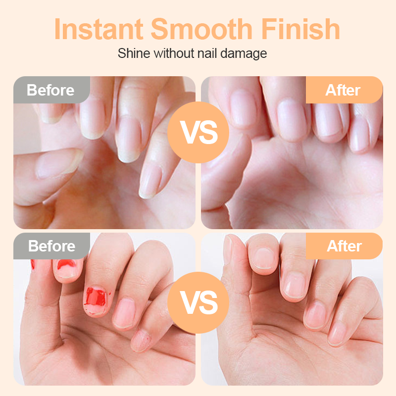 Limited Stock!!! 💗LAST DAY SALE 49% OFF⚡50K+ SOLD💕🌟AEXZR® 2-in-1 Safe Electric Nail Clipper